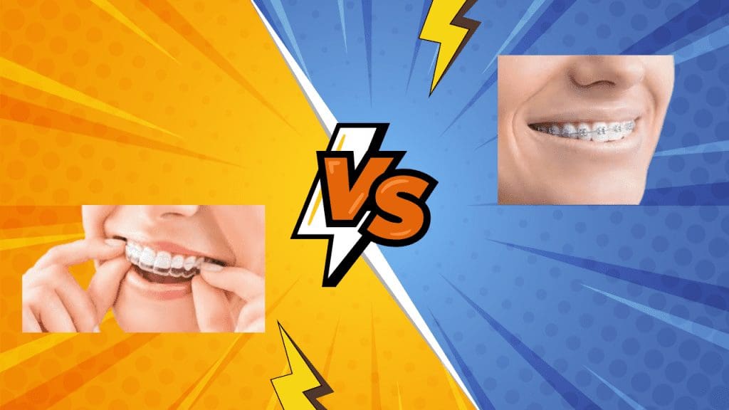 Invisalign-vs-Braces